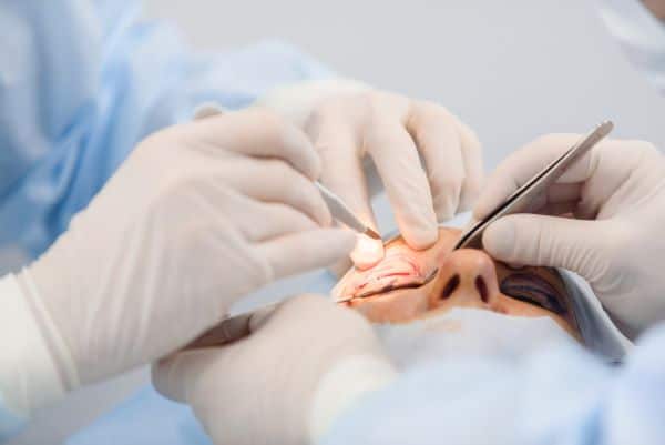 Blefaroplastia - cirurgia para tratar ptose palpebral