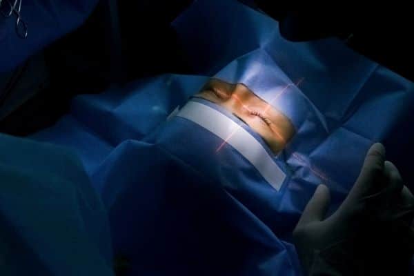 Paciente e equipe de cirurgiões na sala de cirurgia durante cirurgia oftalmológica tratamento Lasik. Paciente sob cobertura estéril.