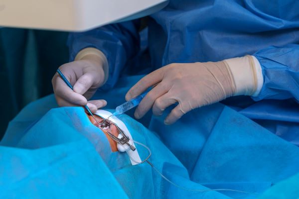 Cirurgião administrando medicamento no olho de paciente durante o procedimento de cirurgia ocular.