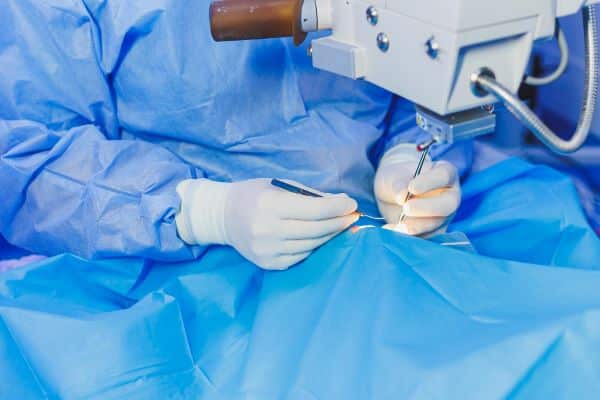 Um paciente sob um microscópio cirúrgico enquanto o cirurgião realiza a cirurgia ocular facorrefrativa para correção da visão.