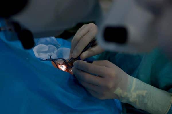 Imagem de cirurgia de córnea. O médico executa manipulações no olho com instrumentos cirúrgicos.