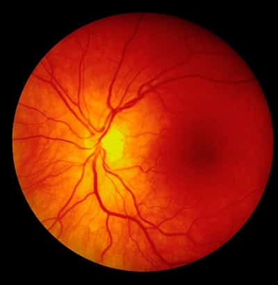 Fotografia de fundo da retina humana.