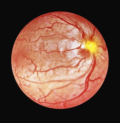 Globo ocular visto por um exame de tomografia óptica.
