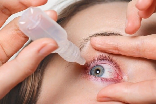Mulher de olhos claros pinga colírio no olho direito.
