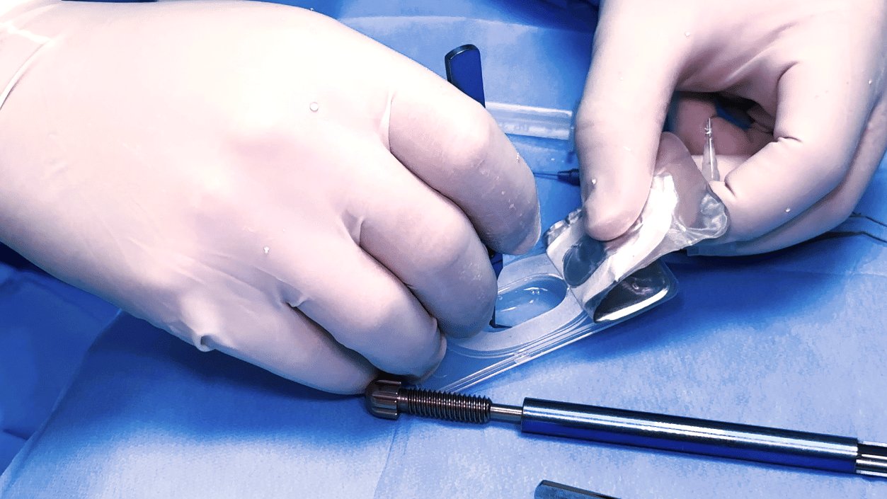 cirurgia-de-catarata-refrativa-oftalmologia-integrada.jpg (13)