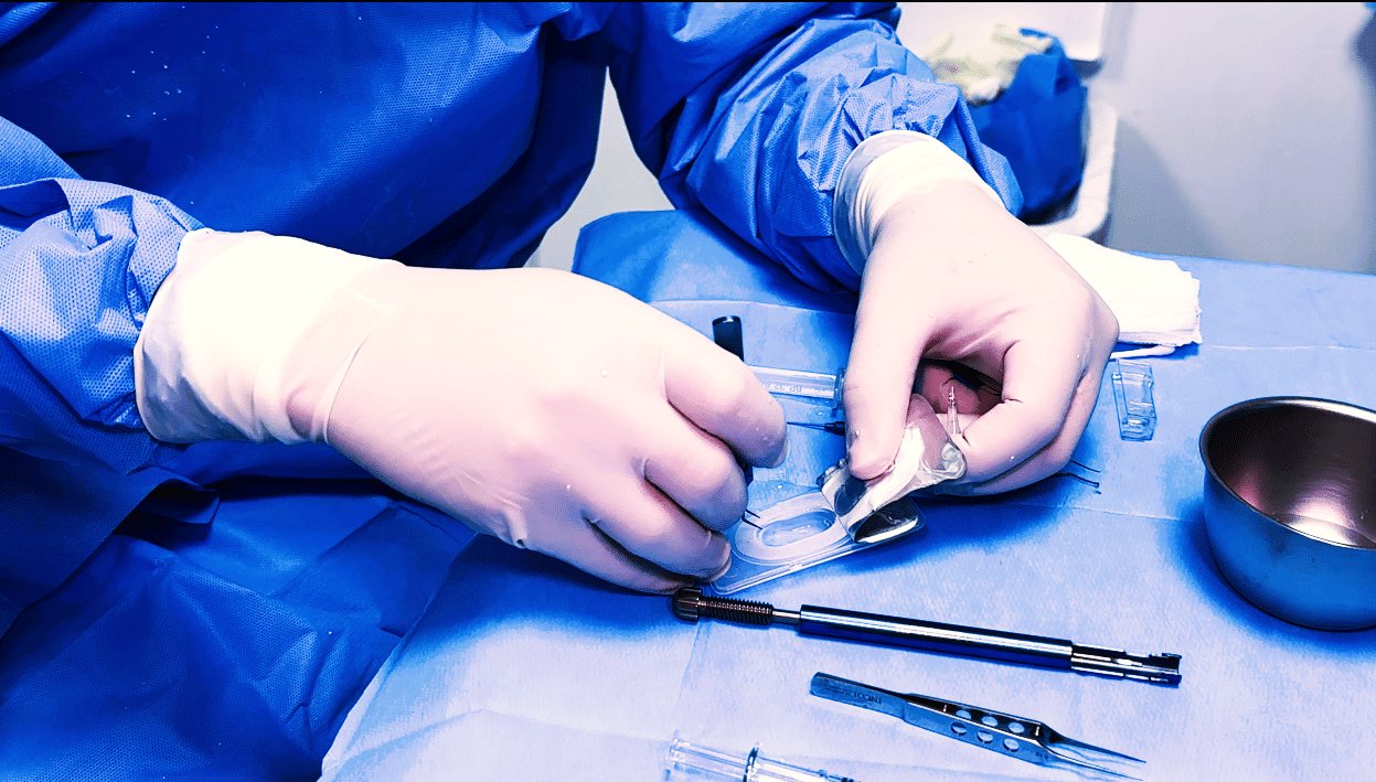 cirurgia-de-catarata-refrativa-oftalmologia-integrada.jpg (3)