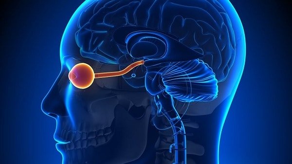 Imagem da parte interna da cabeça de uma pessoa acometida por neuromielite óptica. Nela destaca-se o nervo óptico inflamado.
