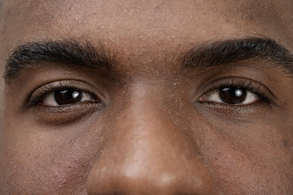Close dos olhos escuros de um paciente negro.